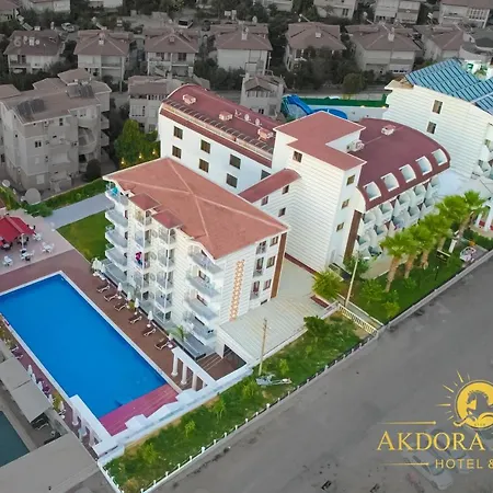 酒店 Akdora & Spa 锡德